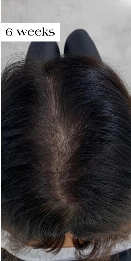 After consistent care