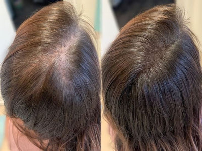 My roots look fuller and healthier